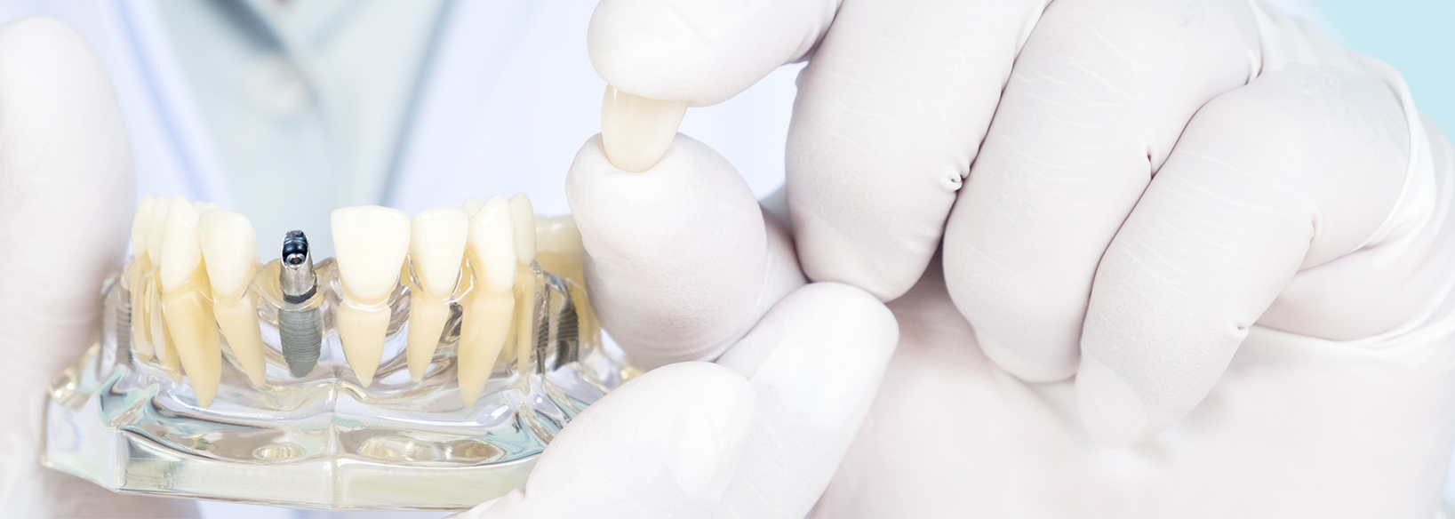 Gloved hands holding a plastic model of the teeth with dental implants in Fredericksburg