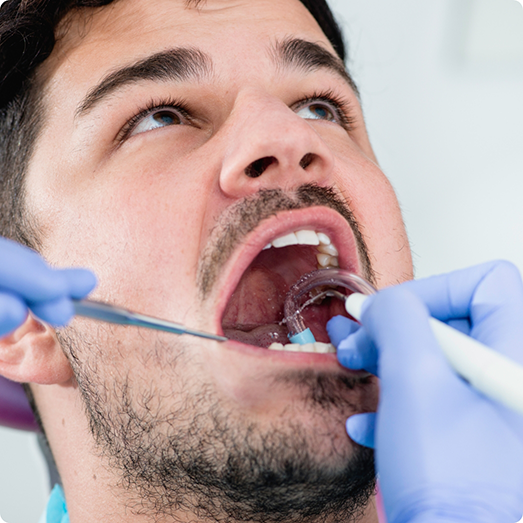 Close up of a male dental patient having his teeth examined