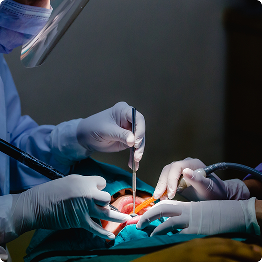 Close up of patient during wisdom tooth extraction
